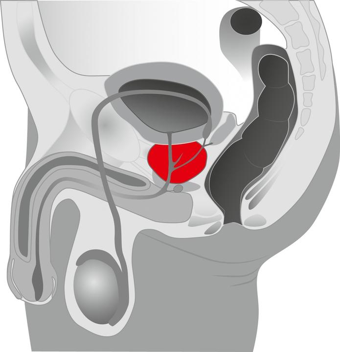 Actual product image You2Toys Prostate Twister