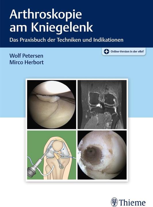 Image du produit Petersen:Arthroskopie am Kniegelenk (Allemand, 2020)