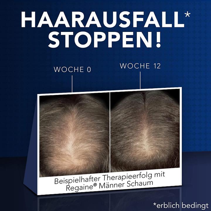 Produktbild Regaine 3x 60ml Haarwachstum