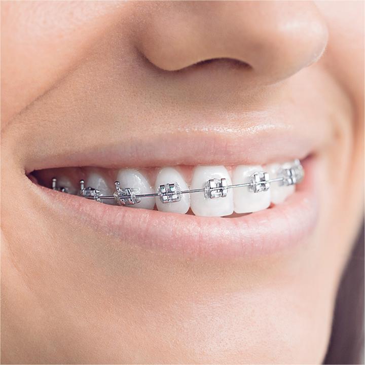 Produktbild Oral-B Ortho Care Essentials (3 x)