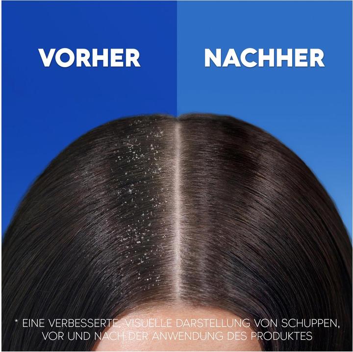 Immagine prodotto Head & Shoulders AppleFresh (500 ml, Shampoo liquido)