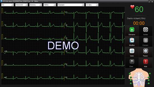 Actual product image Edan Resting ECG SE-1515 DP12 (USB)