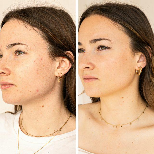 Image du produit Endro Sérum naturellement anti-imperfections (30 ml)