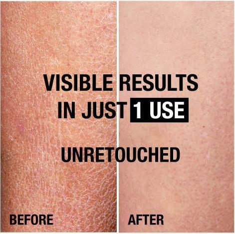 Immagine prodotto Neutrogena Norwegian Formula® Rinnova Visibilmente (Lozione corpo, 400 ml)
