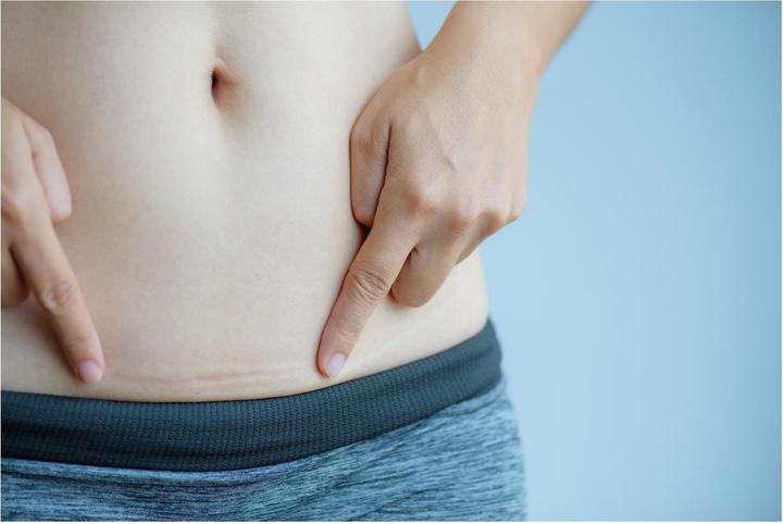 Actual product image Hansaplast Narben Reduktion Pflaster XL (21 x)