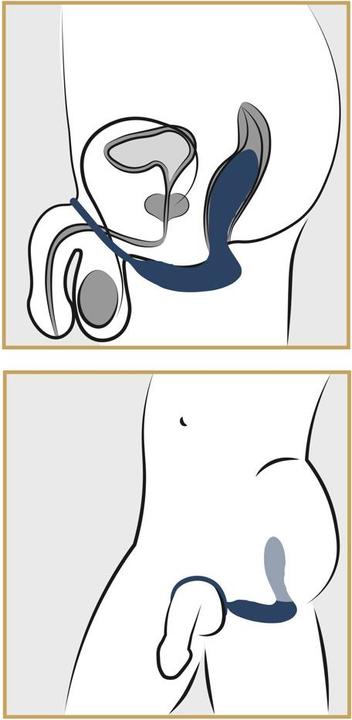 Actual product image You2Toys Vibrating Prostate Plug With Cockring