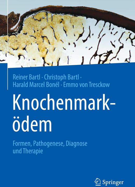 Image du produit Knochenmarködem (Allemand, Reiner Bartl, Harald Marcel Bonél, Emmo von Tresckow, Christoph Bartl, 2023)