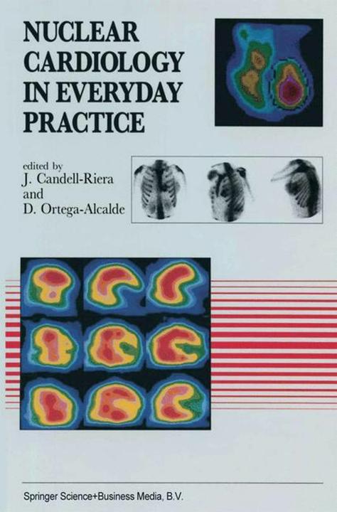 Immagine prodotto Nuclear Cardiology in Everyday Practice (Inglese, J. Candell-Riera, D. Ortega-Alcalde, 2012)