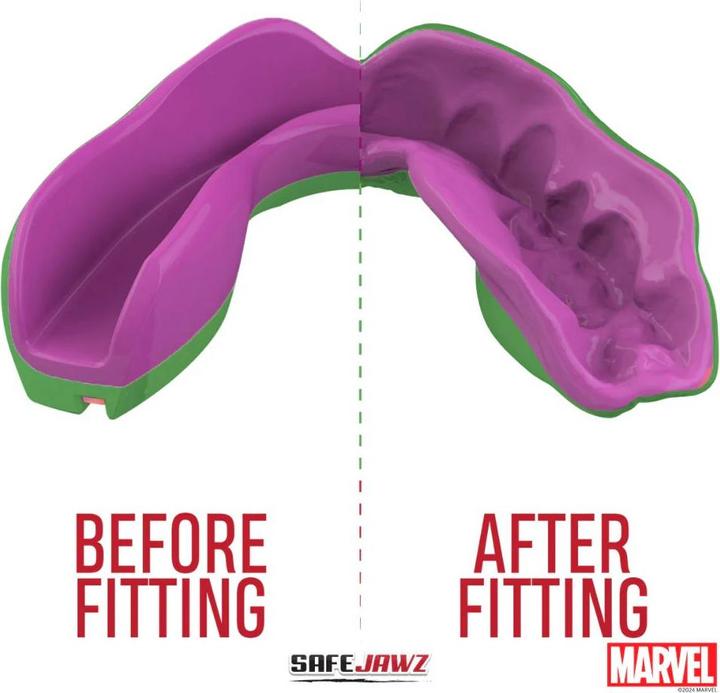 Produktbild SafeJawz Marvel The Hulk Mundschutz