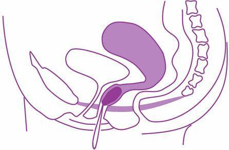Actual product image Elanee Pelvic floor training aids (28 - 74 g)