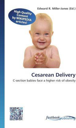 Produktbild FastBook Publishing Cesarean Delivery (Edward R. Miller-Jones, 2012)