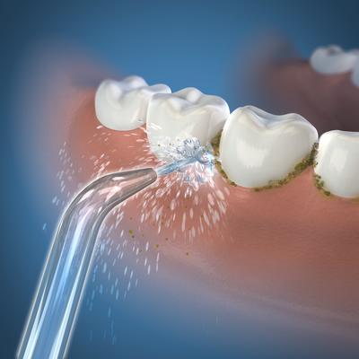 Immagine prodotto Waterpik Wp60/70/90e (Accessori per irrigatori orali)