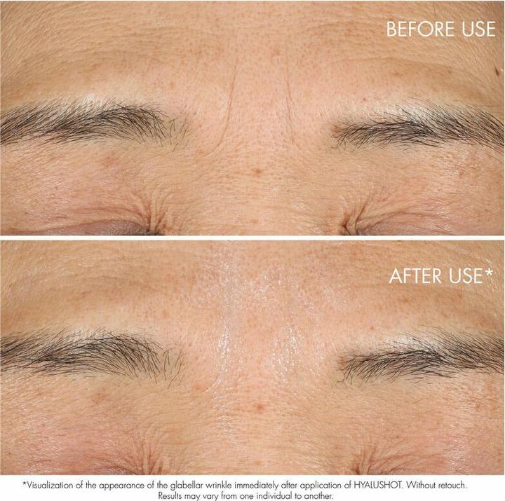 Produktbild Dior Hyalushot Concentre (Serum, 15 ml, Nacht)