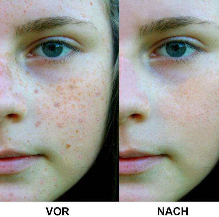 Produktbild Signstek Gesichtspflegegerät