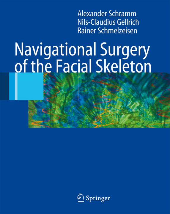 Actual product image Navigational Surgery of the Facial Skeleton (Dutch, Rainer Schmelzeisen, Nils-Claudius Gellrich, Alexander Schramm, 2016)