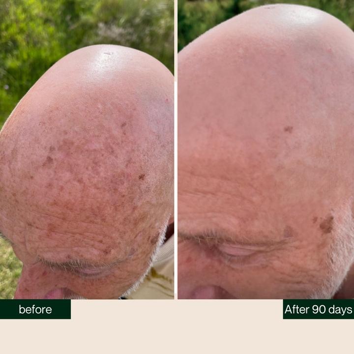 Produktbild Better be bold Bartöl und Glatzenöl - Bald Head & Beard Oil with Diamond Shine-Effect