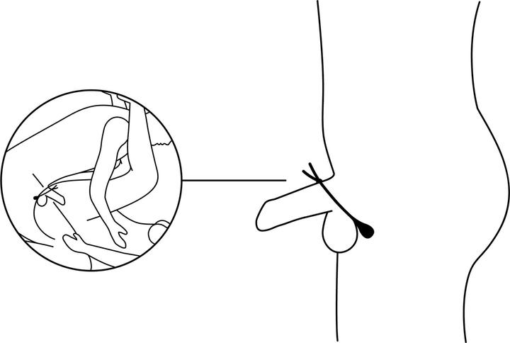 Actual product image Nexus Forge Vibrating Adjustable Lasso Cock Ring (4 cm)