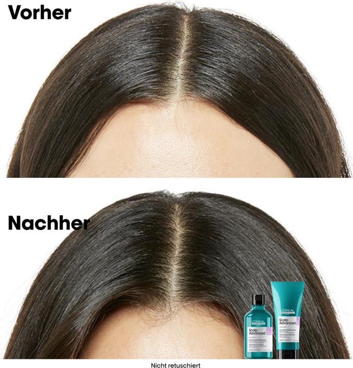 Actual product image L'Oréal Professionnel Série Expert Scalp Advanced - Anti-Discomfort Dermo-Regulator (300 ml, Liquid shampoo)