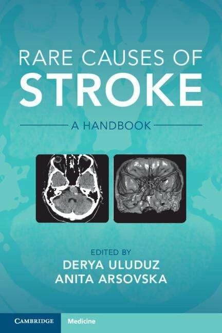Produktbild Rare Causes of Stroke (Englisch, Derya Uluduz, Anita Arsovska, 2022)