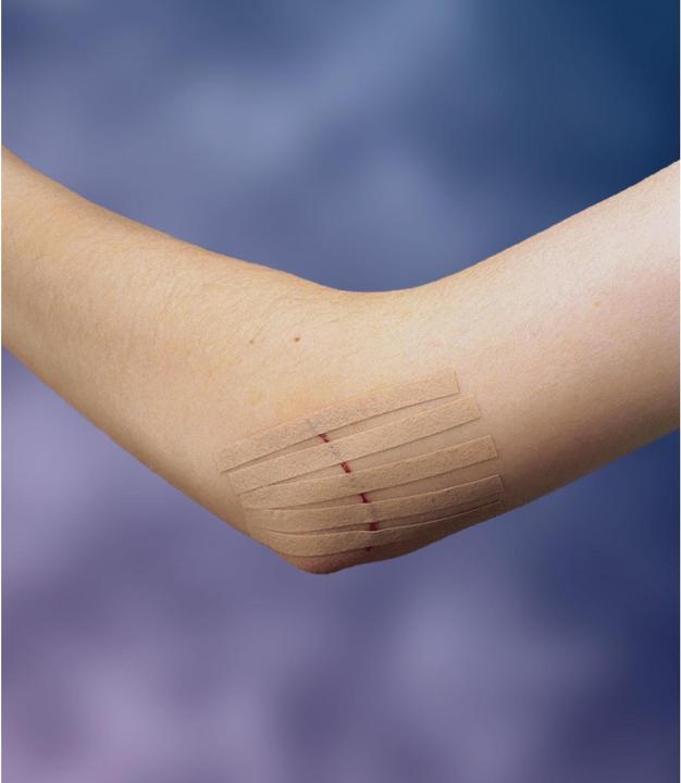 Actual product image Nexcare Steri-Strip wound closure strips (6 x)