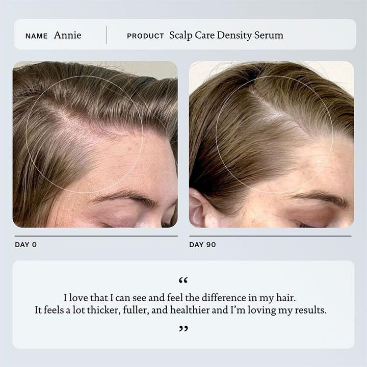 Actual product image Living Proof Scalp Care Density Serum 1.7 Fl Oz (50 ml)