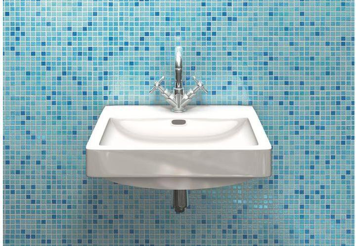 Produktbild Tox Waschtischbefestigung Oase 14x75 mm 2 Stück (2 Stk.)
