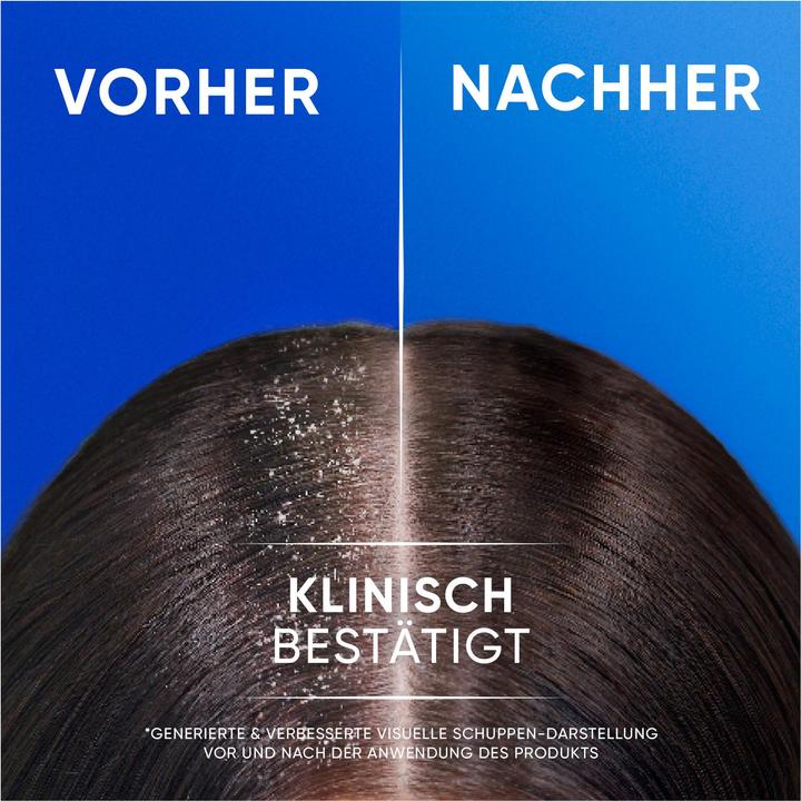 Actual product image Head & Shoulders Anti-Schuppen Shampoo 2in1 Citrus Fresh für fettiges Haar (800 ml, Liquid shampoo)