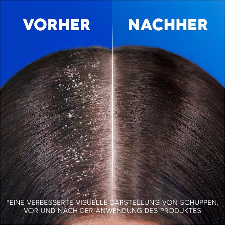 Productafbeelding Head & Shoulders SH AS Kokos (300 ml, Vloeibare shampoo)