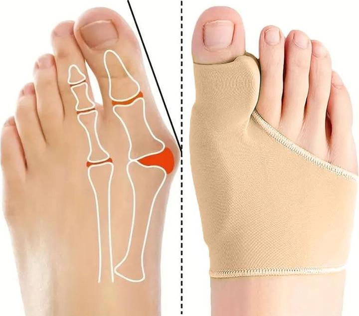 Immagine prodotto Cbx Benda per la correzione dell'alluce valgo con cuscinetto in silicone integrato 2 pezzi (Crema piedi e gel piedi)