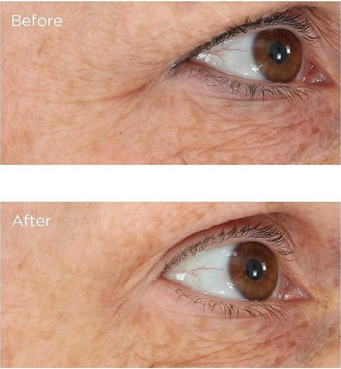Produktbild Perricone MD Essential Fx Acyl-Glutathione: Eyelid Lift Serum (15 ml)