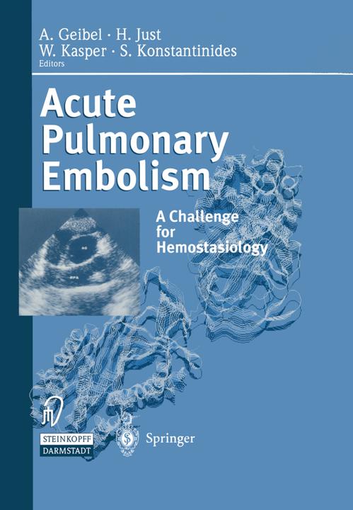 Actual product image Acute Pulmonary Embolism (S. Konstantinides, A. Geibel, W. Kasper, Hanjörg Just, 2012)