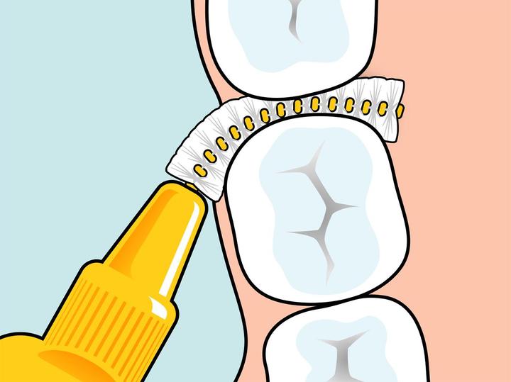 Actual product image TePe Interdentalbürsten Original Orange ISO 1 (8 x, 0.45 mm)