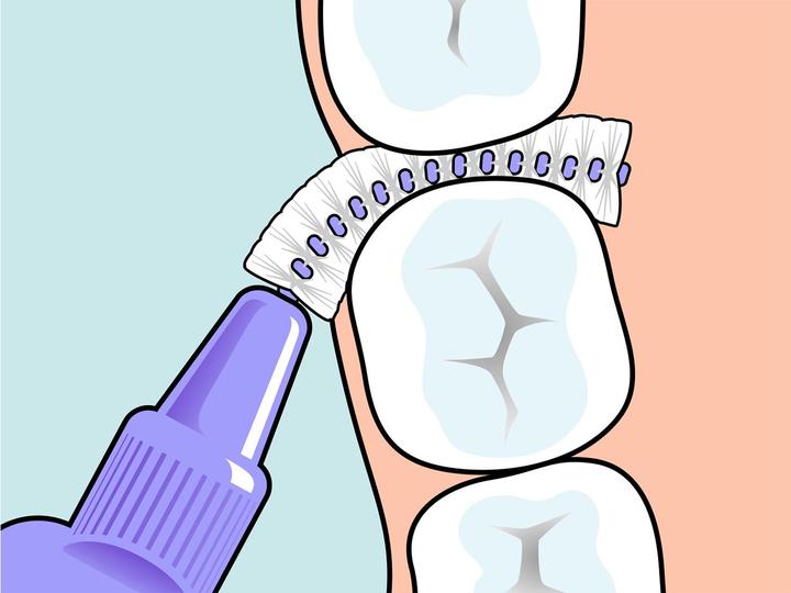 Image du produit TePe Interdentalbürsten Original Lila ISO 6 (1 x, 1.10 mm)