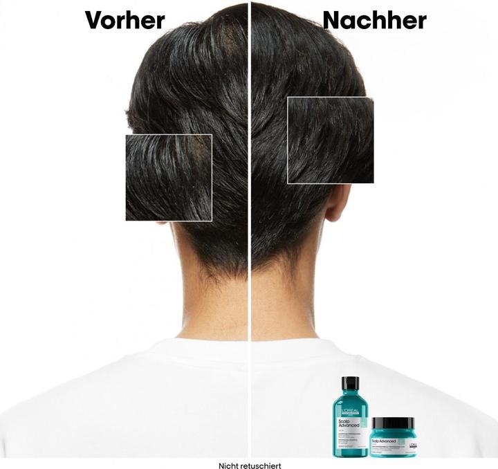 Image du produit L'Oréal Professionnel Scalp Advanced (250 ml)