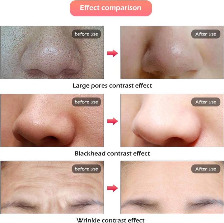 Produktbild Deciniee Lichttherapie-Maske