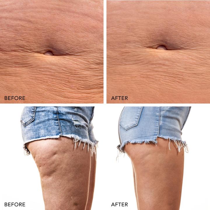 Image du produit Foreo Bear