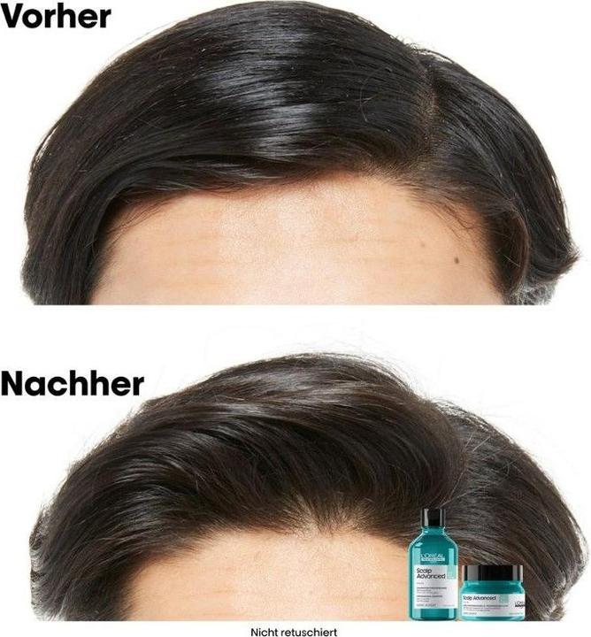 Image du produit L'Oréal Professionnel Scalp Advanced (250 ml)