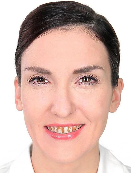 Produktbild Maskworld Zahnlack Nikotin 10ml Pinselflasche