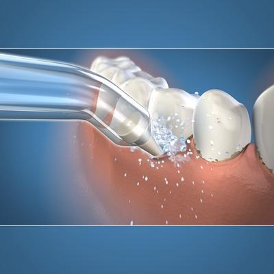 Produktbild Waterpik PP-100 Pik Pocket (Mundduschenaufsätze)