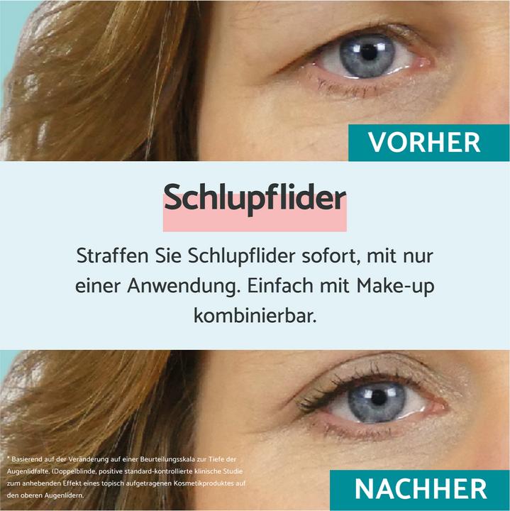 Produktbild Remescar Schlupflider (Crème, 8 ml, Tag)