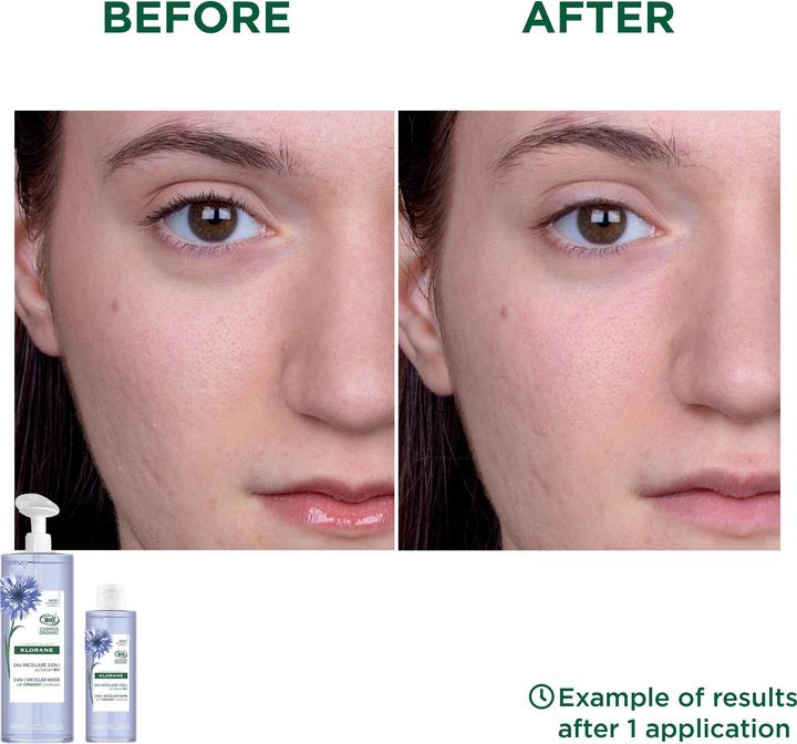 Image du produit Klorane Bleuet Lotion Micellaire Visage & Yeux Bio Lot (Eau micellaire, 400 ml)
