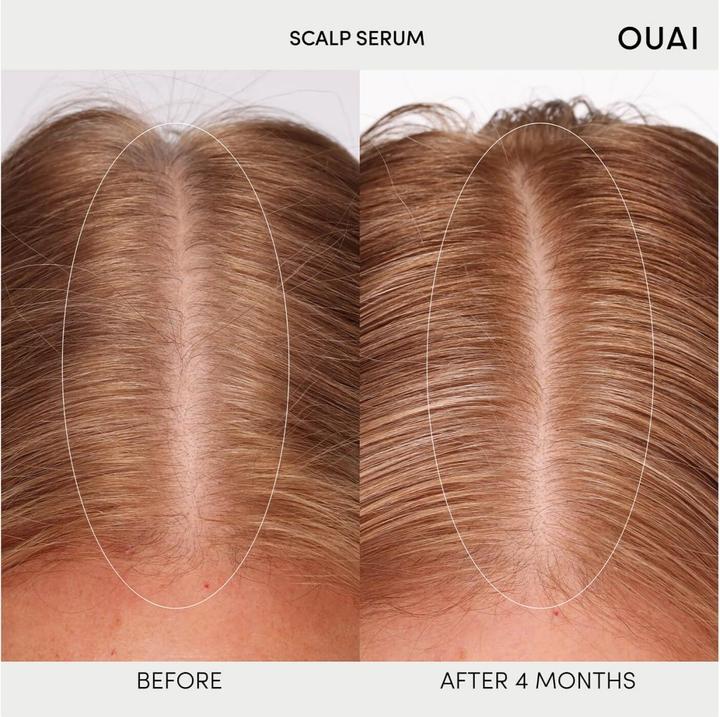 Produktbild Ouai Scalp Serum (60 ml)
