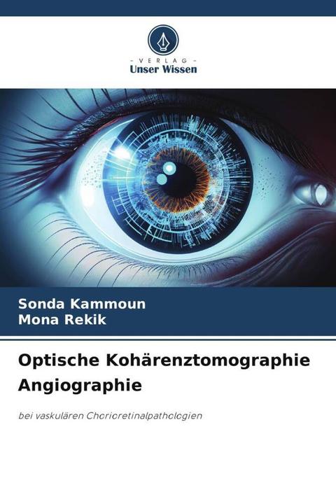 Immagine prodotto Optische Kohärenztomographie Angiographie (Sonda KAMMOUN, Mona REKIK, 2024)
