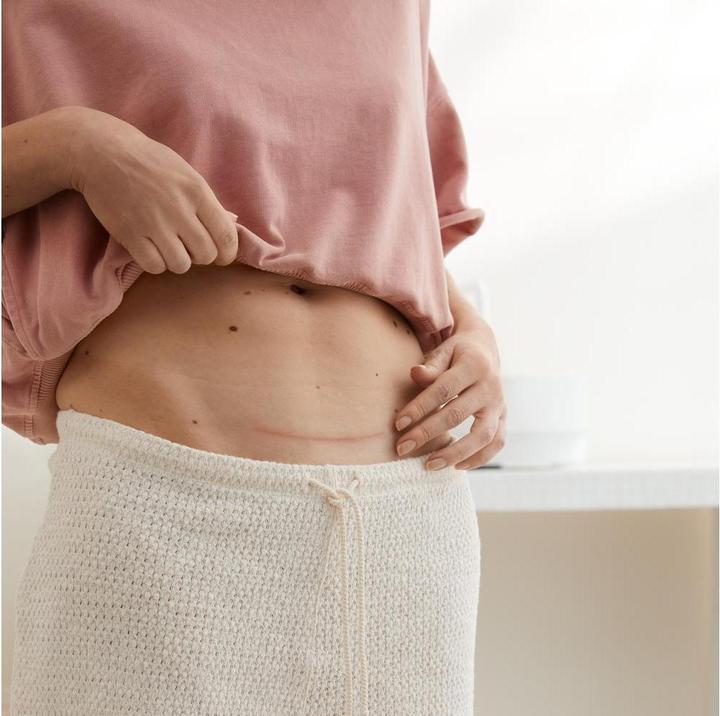 Actual product image Hansaplast Narben Reduktion Pflaster XL (21 x)