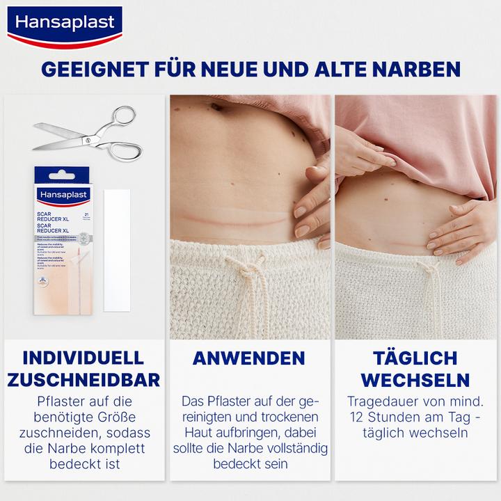 Produktbild Hansaplast Narben Reduktion XL (21 x)