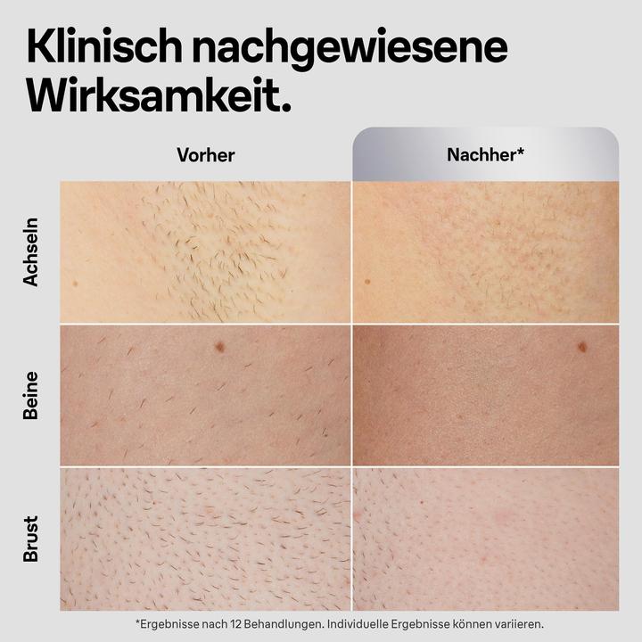 Actual product image Braun Silk-expert Pro 5