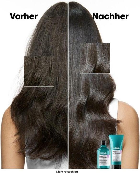 Actual product image L'Oréal Professionnel Série Expert Scalp Advanced - Anti-Discomfort Dermo-Regulator (300 ml, Liquid shampoo)