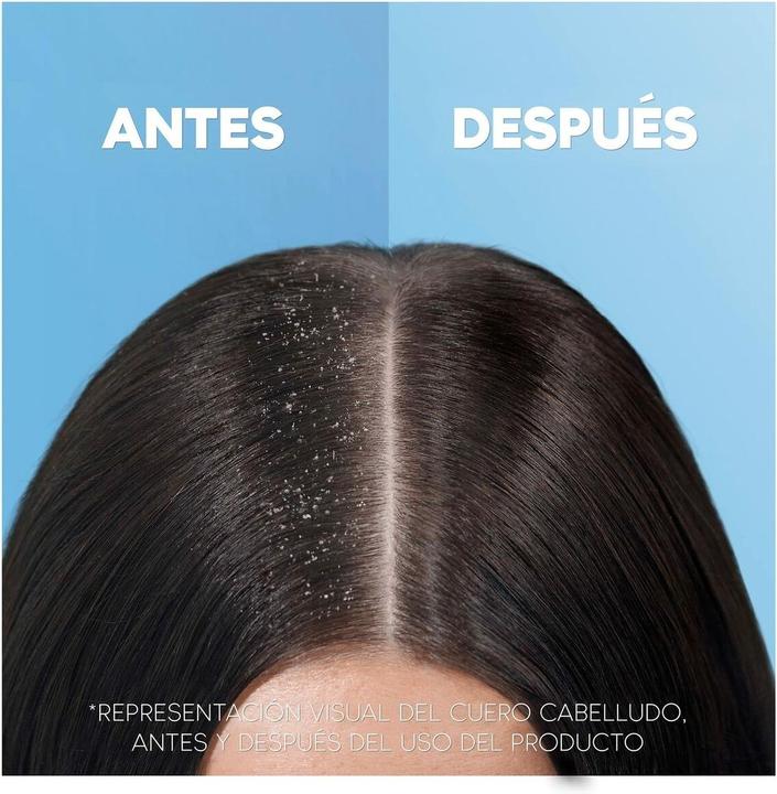 Actual product image Head & Shoulders 2-in-1 Classic (1000 ml, Liquid shampoo)