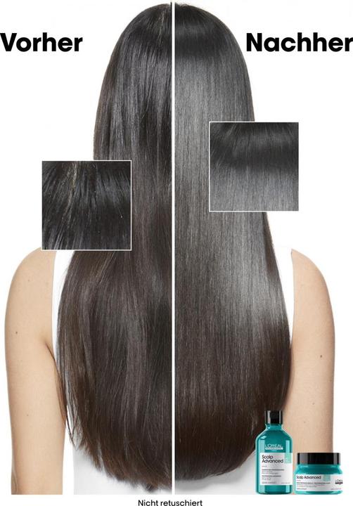 Image du produit L'Oréal Professionnel Scalp Advanced (250 ml)