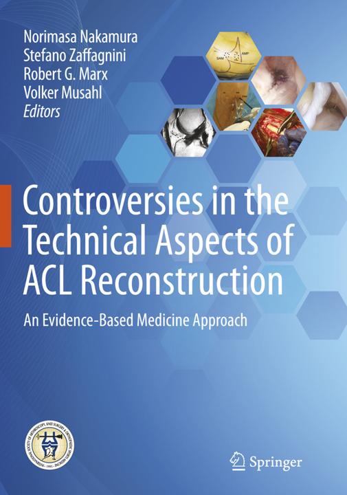 Actual product image Controversies in the Technical Aspects of ACL Reconstruction (English, Stefano Zaffagnini, Volker Musahl, Norimasa Nakamura, Robert G. Marx, 2018)